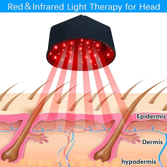 Red Light Therapy Hair Growth Cap - Blinks Emporium