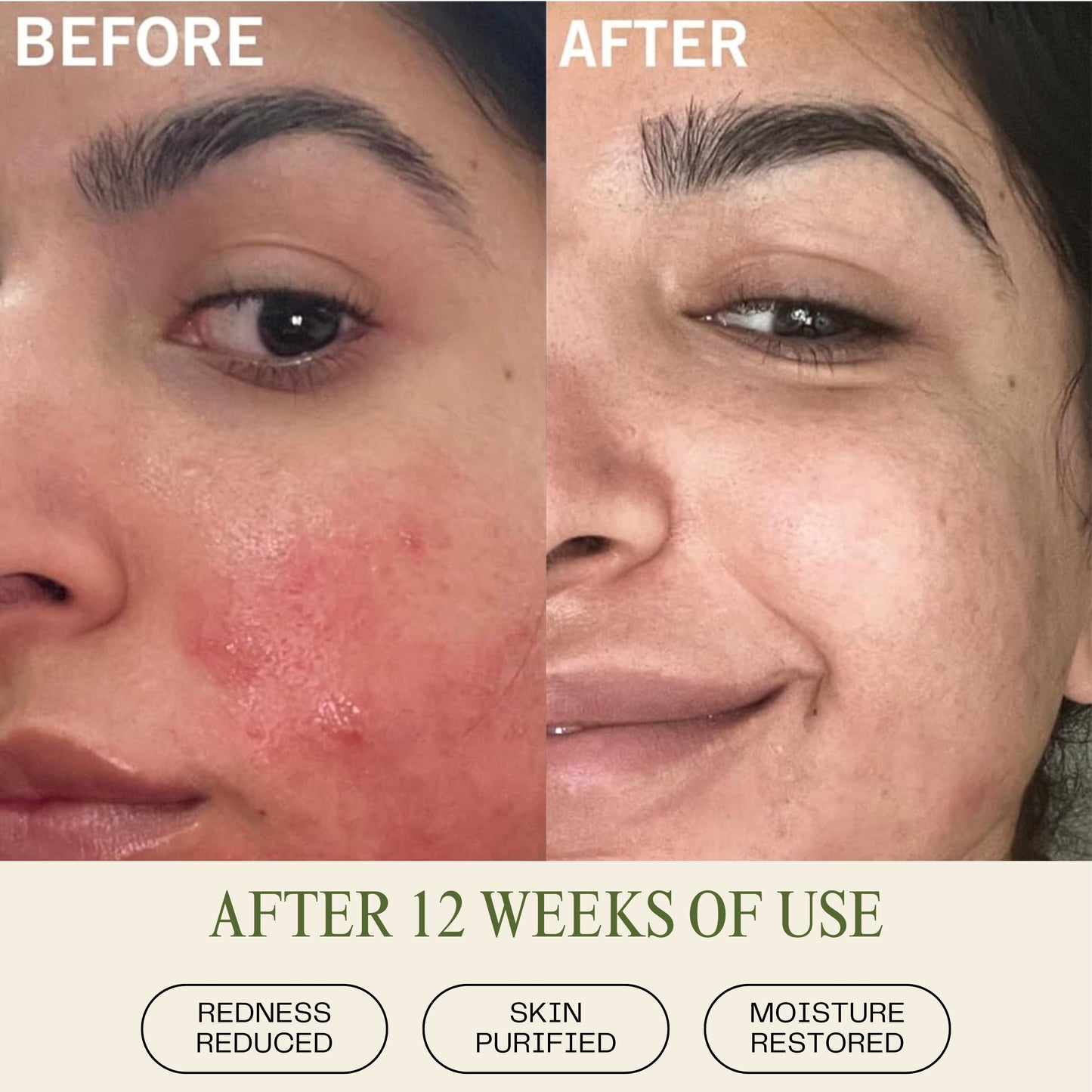 Peach & Basil Balancing Face Cleanser - Blinks Emporium