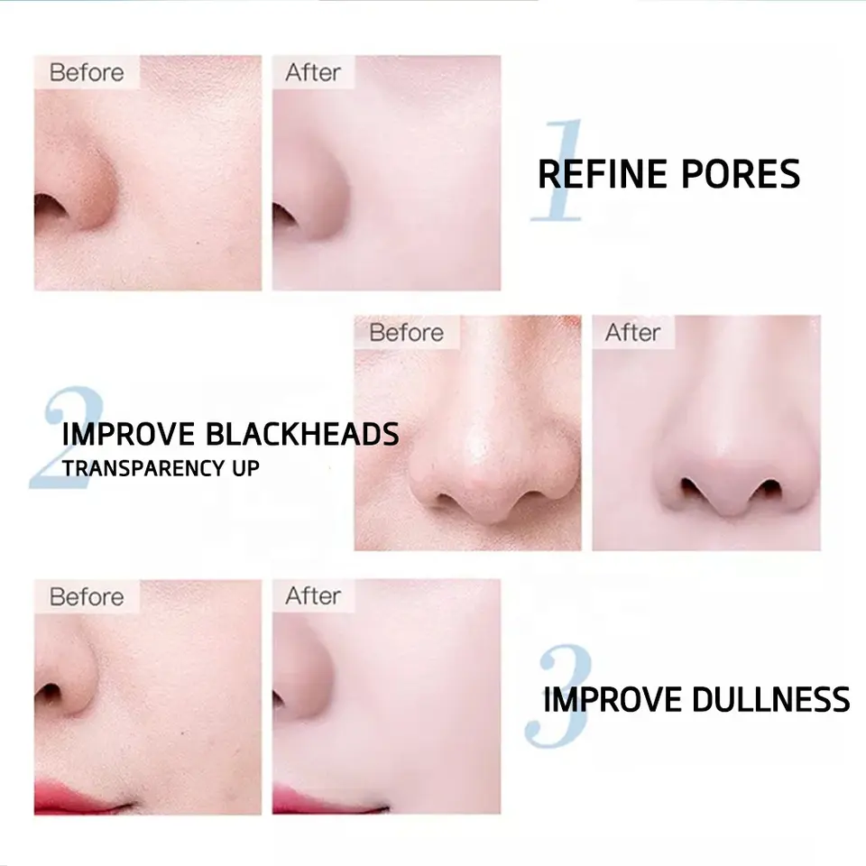 Pure Hyaluronic Acid Serum - Blinks Emporium